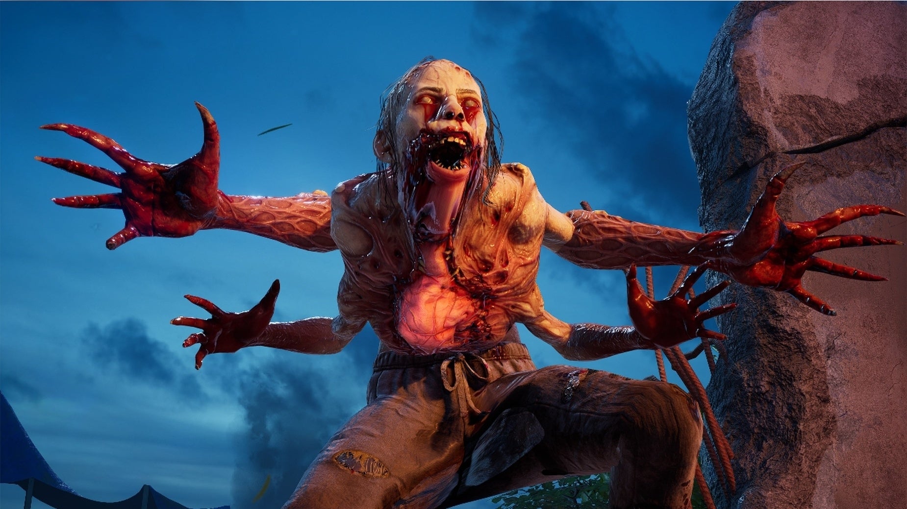 Bilder zu Back 4 Blood: So behebt ihr den "nötiger Patch ist verfügbar" Fehler im Game Pass