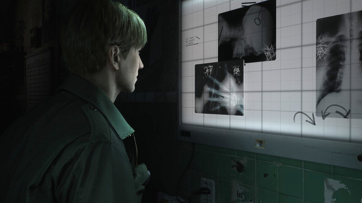 James watching x-ray Silent Hill 2 Remake
